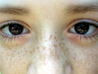 Les blondes avec les taches de rousseur et les yeux noisette